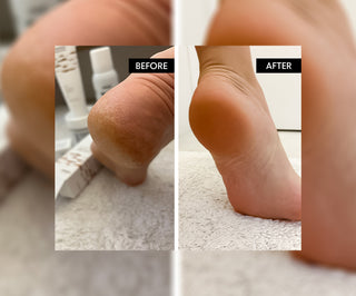 Sare de baie pentru picioare cu uree 45% Refeet