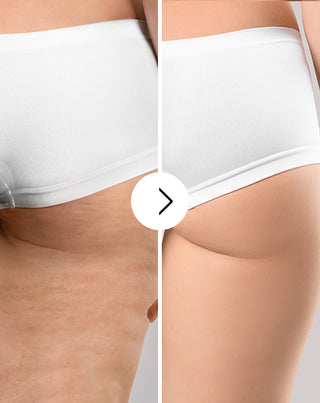 Tablete de ameliorare a celulitei și a pielii cu extracte naturale Cellinea 60 capsule_3 - 3