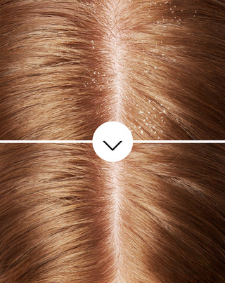 Sampon anti-matreata Nutridome cu olamina piroctona cu efect hidratant - 5