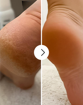 Nutridome cremă de picioare de înmuiere cu uree și unt de shea - 4