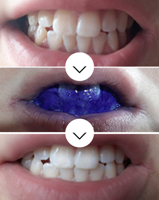 White Bite Smilebite ser corector al culorii dintilor 30 ml