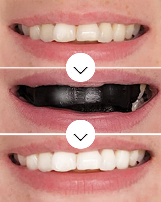 The White(ning) Stripes Smilebite benzi de albire a dintilor set de 28.