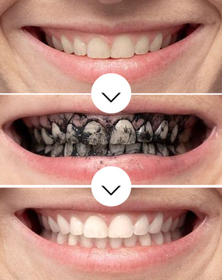 Pudra pentru albirea dintilor cu carbune de cocos Smilebite - 4